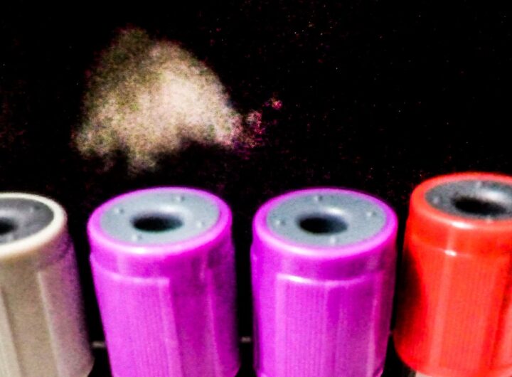 Blood test tubes used to check vitamin B12 levels