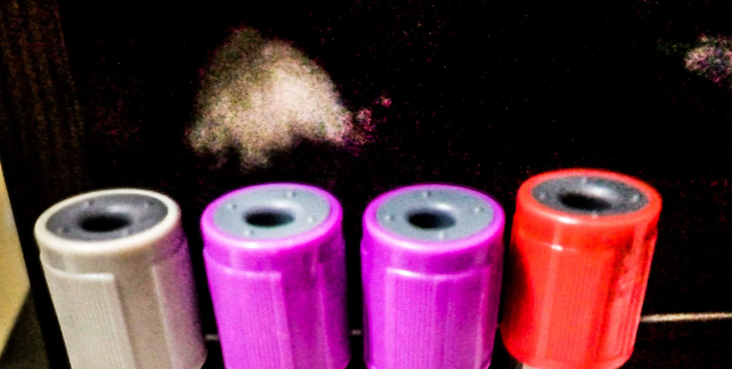 Blood test tubes used to check vitamin B12 levels